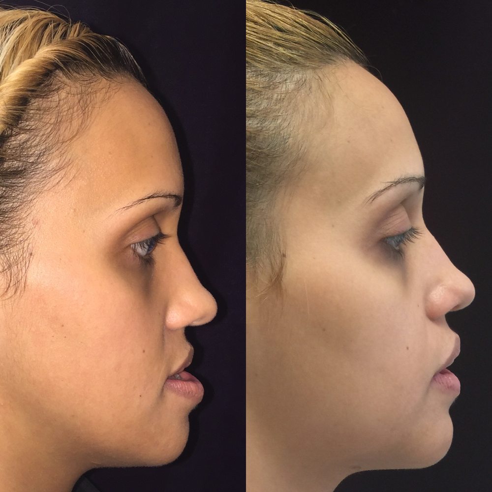 TOP 10 BEST Keloid Removal in Vacaville, CA - Updated 2026 - Yelp