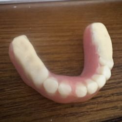 Jennings & Larson Family Dentistry - Bullhead City - Emma all the white stuff he put on there