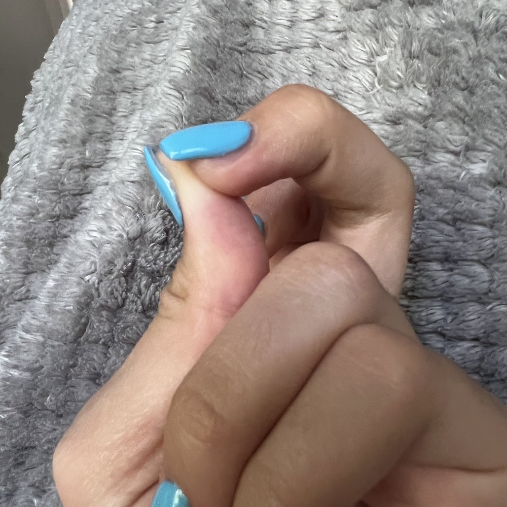 Boca TLC Nails - Messed up nails - Nail Salons Near Me - Boca Raton, Florida