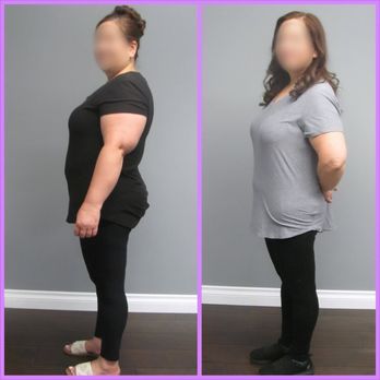 Slimmer Solutions - Look at that difference!!! - Weight Loss Centers Near Me - La Verne, California Slimmer Solutions - Look at that difference!!! - Weight Loss Centers Near Me - La Verne, California