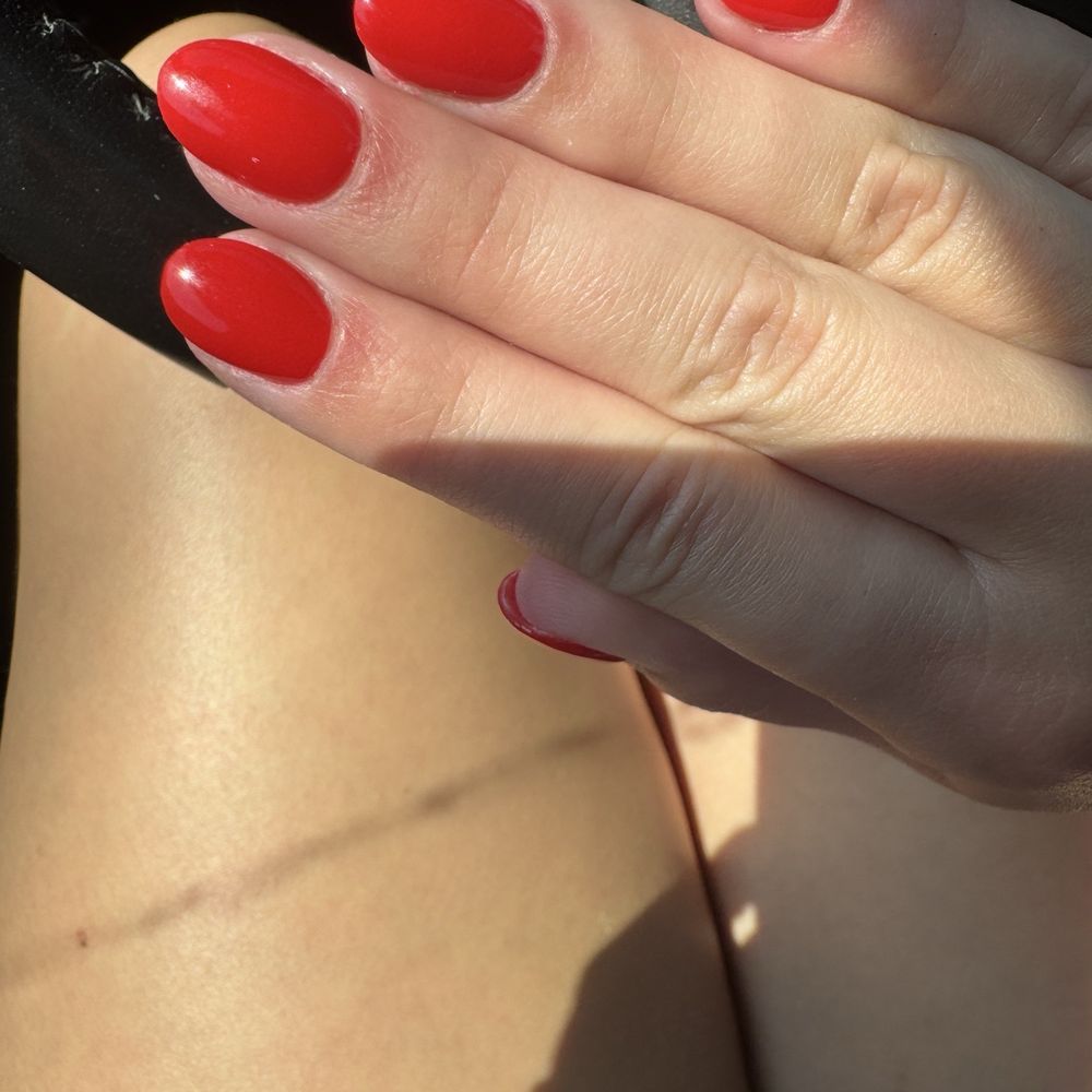 Forest Nails & Spa - Zoom in on my cut cuticles - Day Spas Near Me - Bettendorf, Iowa Forest Nails & Spa - Zoom in on my cut cuticles - Day Spas Near Me - Bettendorf, Iowa