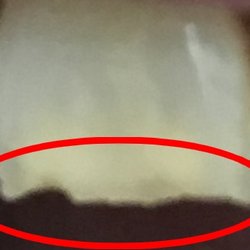 Cannon Family Dentistry - Before