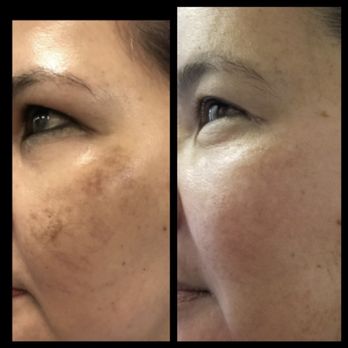 Beverly Hills Skincare Muse - Skin Care Near Me - Beverly Hills, California