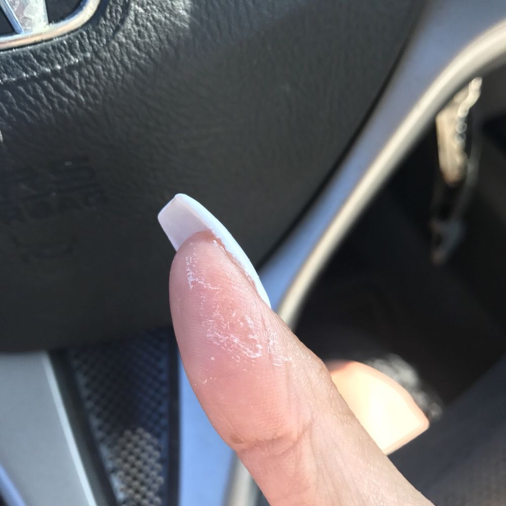 Elite Nails & Spa - The nasty glue residue MARK LEFT ON MY HANDS!! This ISNT normal for an expensive nail salon! Horrible. - Nail Salons Near Me - Placentia, California Elite Nails & Spa - The nasty glue residue MARK LEFT ON MY HANDS!! This ISNT normal for an expensive nail salon! Horrible. - Nail Salons Near Me - Placentia, California