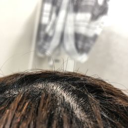 Damaged hair, broken at the point where the hair stylist started pulling for hair straightening. Damaged hair, broken at the point where the hair stylist started pulling for hair straightening.