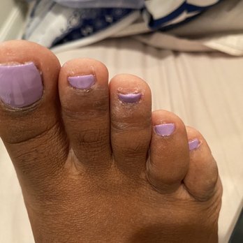 Inspire Nail Bar & Spa - Botched pedicure - Nail Salons Near Me - Baltimore, Maryland Inspire Nail Bar & Spa - Botched pedicure - Nail Salons Near Me - Baltimore, Maryland
