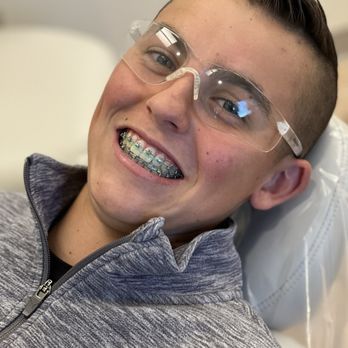 Hoff Orthodontics - Removal day - Orthodontists Near Me - Upland, California