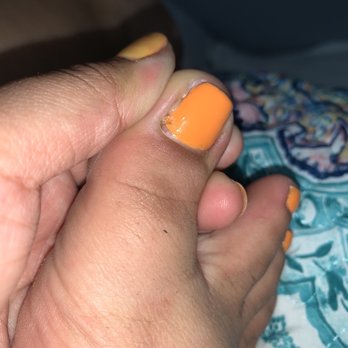 Envy Nails & Spa - Infected toe because she cut too deep and it was PAINFUL. I can't walk correctly because of how much it hurts. - Nail Salons Near Me - Austin, Texas