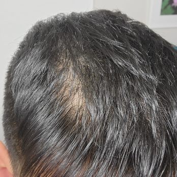 Supercuts - Part of my hair where they used the thinning shears way too much. - Hair Salons Near Me - SAN JOSE, California Supercuts - Part of my hair where they used the thinning shears way too much. - Hair Salons Near Me - SAN JOSE, California
