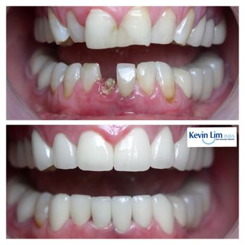 Von Karman Dental - Cosmetic Dentists Near Me - Irvine, California Von Karman Dental - Cosmetic Dentists Near Me - Irvine, California
