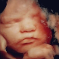 Miracle View 3D/4D Ultrasound