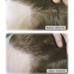 Australian Hair & Scalp Clinic