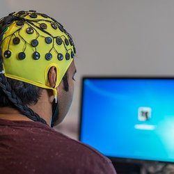 Tucson Neurofeedback - This is what a typical neurofeedback session would look like, with sensors attached to scalp and fed into specialized software.