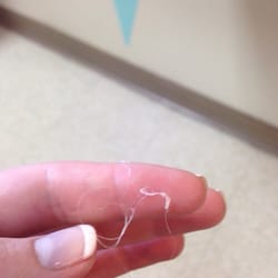 Hairlines - Here is a picture of my white melted hair as it fell off my head.
