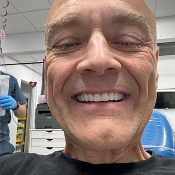 The Smile Mission - After - General Dentistry Near Me - Sanford, Florida The Smile Mission - After - General Dentistry Near Me - Sanford, Florida