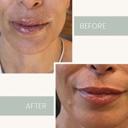 Desert Derma MedSpa: Linda Beymer, MSN-RN