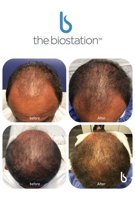 the biostation by null