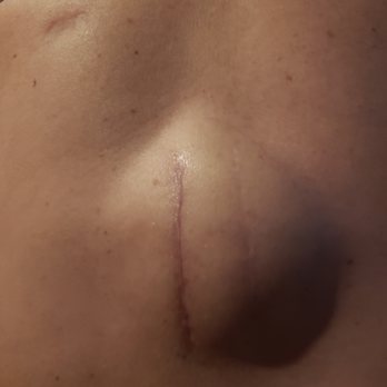 OrthoArkansas  - Tumor Cappocelli created. - Orthopedists Near Me - Little Rock, Arkansas