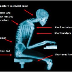 TriStar Family Chiropractic - Ergonomic and work place wellness workshops are also one of Dr. Gloria's passions.
