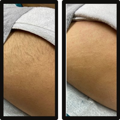 Say goodbye to unwanted hair! - Tired of the hassle of constant shaving and razor burns? Experience smooth, hair-free skin that lasts longer with our professional waxing services. With 13 years of experience as a Licensed Cosmetologist, my mission is to craft an oasis where every individual, irrespective of their skin color, background, or gender, can bask in the glow of feeling acknowledged, valued, and confident on their path to radiant skin Say goodbye to unwanted hair! - Tired of the hassle of constant shaving and razor burns? Experience smooth, hair-free skin that lasts longer with our professional waxing services. With 13 years of experience as a Licensed Cosmetologist, my mission is to craft an oasis where every individual, irrespective of their skin color, background, or gender, can bask in the glow of feeling acknowledged, valued, and confident on their path to radiant skin