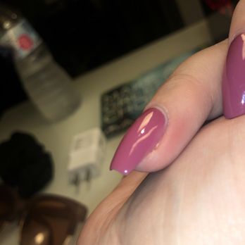 NiNi Nails Salon - Sore red nail bed with yellow pus - Nail Salons Near Me - Tampa, Florida NiNi Nails Salon - Sore red nail bed with yellow pus - Nail Salons Near Me - Tampa, Florida