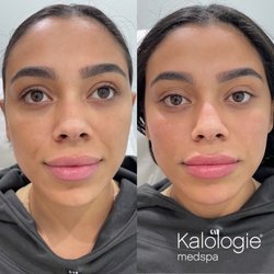 Kalologie Medspa Paradise Valley