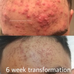 San Diego Skin And Acne Specialist
