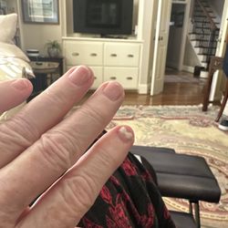Luxury Nails and Spa - When they removed the acrylic it damaged my nail bed