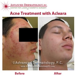 Advanced Dermatology