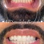 Photo of Ap Smile By Reyem