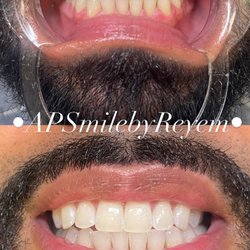 Ap Smile By Reyem