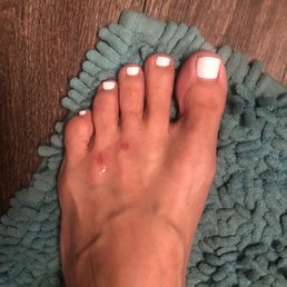 Scrubbed my foot so hard during a pedicure he took my skin off. It's been 5 days and still open cuts! Scrubbed my foot so hard during a pedicure he took my skin off. It's been 5 days and still open cuts!
