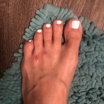 Retreat Nail Spa - Scrubbed my foot so hard during a pedicure he took my skin off. It's been 5 days and still open cuts! - Nail Salons Near Me - Las Vegas, Nevada Retreat Nail Spa - Scrubbed my foot so hard during a pedicure he took my skin off. It's been 5 days and still open cuts! - Nail Salons Near Me - Las Vegas, Nevada