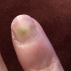 HN Nails & Spa - Fungus on my nail.
