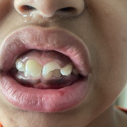 Dentistry for Families - The before