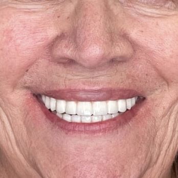 Tru-Value Dental and Denture - General Dentistry Near Me - Mesa, Arizona Tru-Value Dental and Denture - General Dentistry Near Me - Mesa, Arizona
