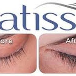 NU Body Weight Loss & Aesthetics - Latisse