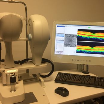 Today's Vision - OCT technology - Optometrists Near Me - Dallas, Texas