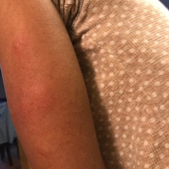 Nockamixon State Park - SISTERS ARMS FROM BEDBUGS! - Boating Near Me - Quakertown, Pennsylvania Nockamixon State Park - SISTERS ARMS FROM BEDBUGS! - Boating Near Me - Quakertown, Pennsylvania