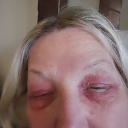 I put reviews on Sephora on page. They took them down.