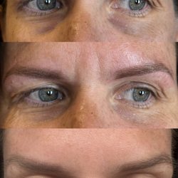 See the brow transformation: before, immediately after, and healed microshaded brows for soft, natural-looking, long-lasting definition.