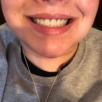 Aspen Dental - Highland, IN - Dentures - General Dentistry Near Me - Highland, Indiana Aspen Dental - Highland, IN - Dentures - General Dentistry Near Me - Highland, Indiana