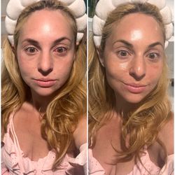 The Tahoe Aesthetician - Before and after facial!