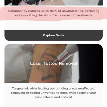 LASERAWAY - Updated December 2025 - 62 Photos & 59 Reviews - 932 Old ...