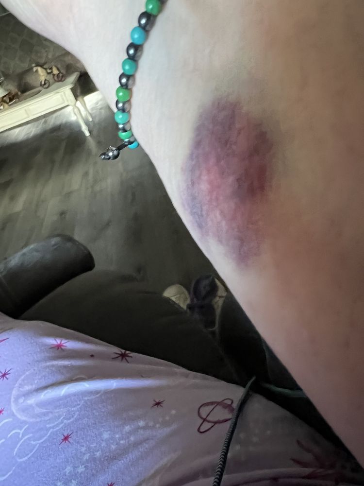 UPMC Memorial - patient advocate in York, PA