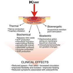 Active Body Chiro-Care - Dr. Hogan specializes in Laser Therapy