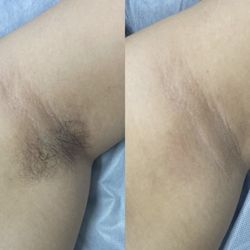 Skin & Body Studio - I got a free underarm wax too!
