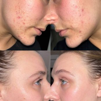 The Glow - Skin Care Near Me - Spokane, Washington