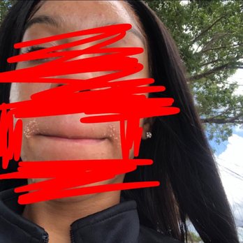 Crystal Nails And Spa - lip wax.... i didn't pop them bc it's not gonna help - Nail Salons Near Me - Hialeah, Florida Crystal Nails And Spa - lip wax.... i didn't pop them bc it's not gonna help - Nail Salons Near Me - Hialeah, Florida