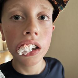 Progress Ridge Orthodontics - Thank GOODNESS they could see my busted up boy and help him feel better!!